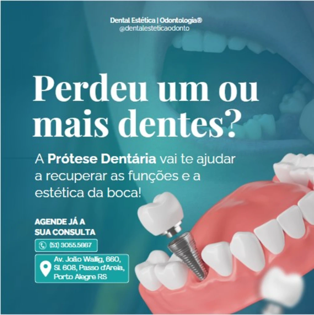 Dental Estética